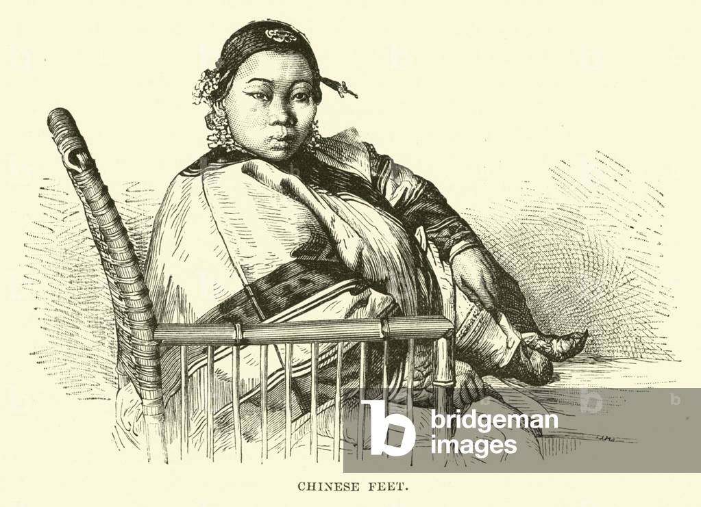 Chinese Feet (engraving)