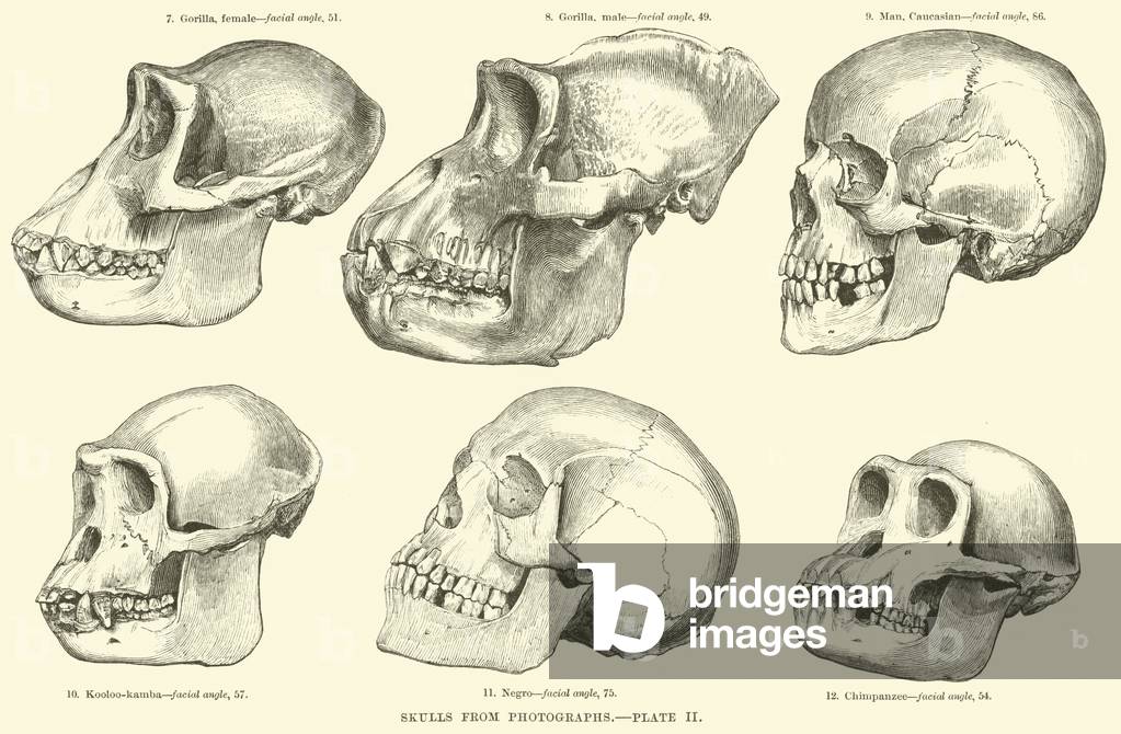 Skulls from Photographs (engraving)