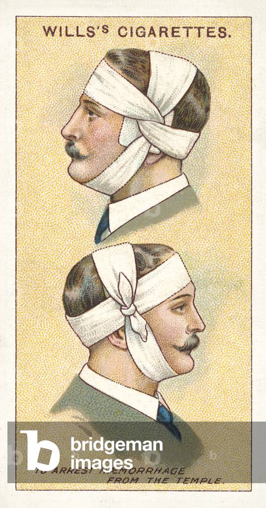 First Aid, To arrest haemorrhage from the temple (chromolitho)