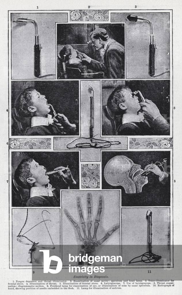 Eelctricity in diagnosis (b/w photo)