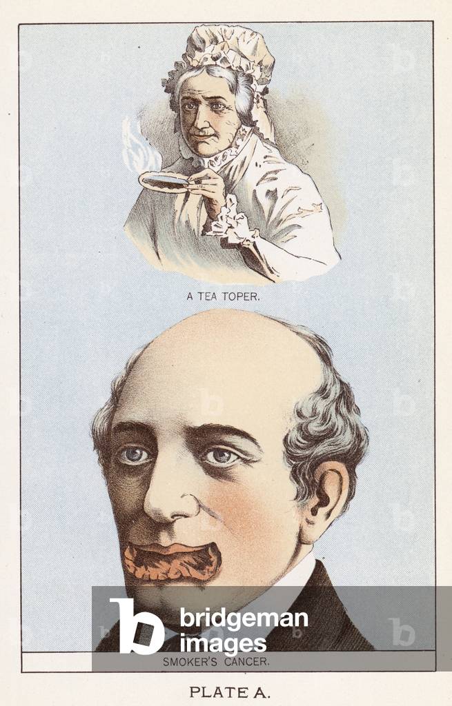 A Tea Toper, Smoker's Cancer (colour litho)