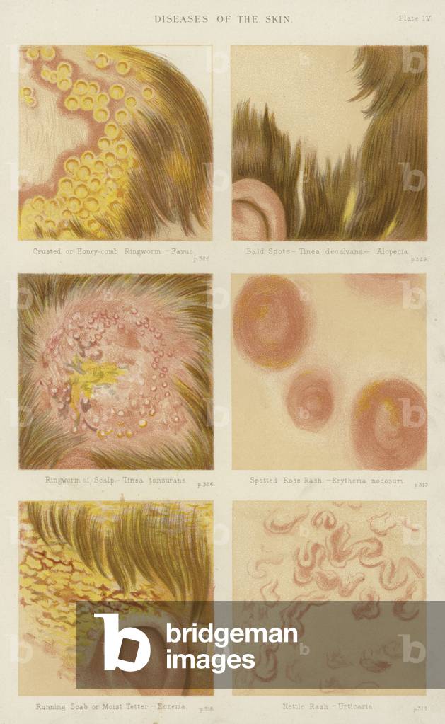 Diseases of the skin (colour litho)