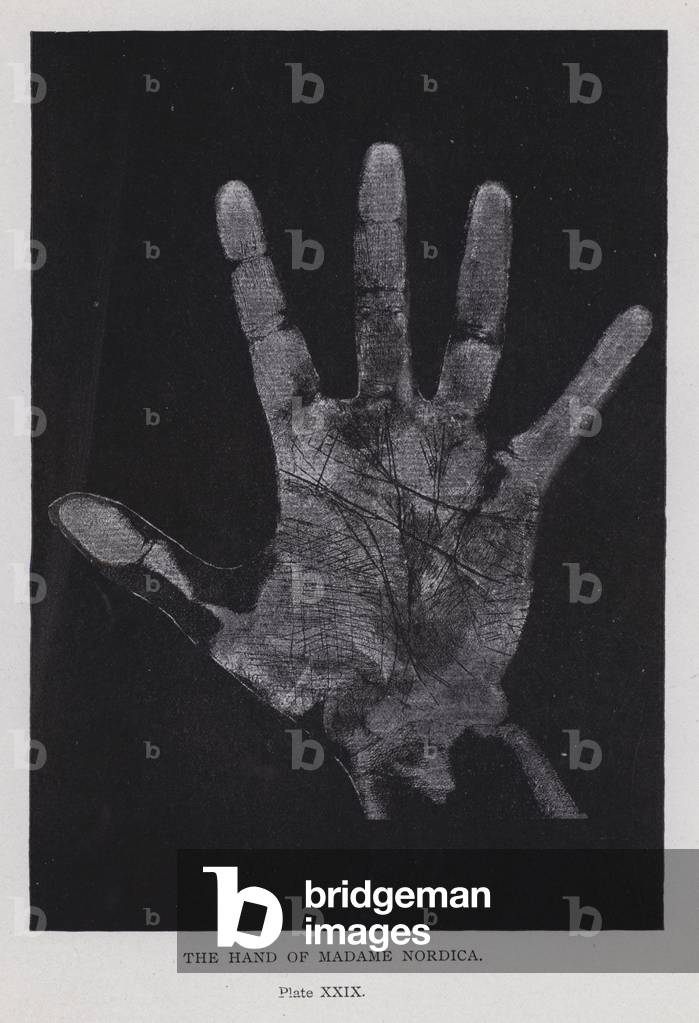 The hand of Madame Nordica (b/w photo)