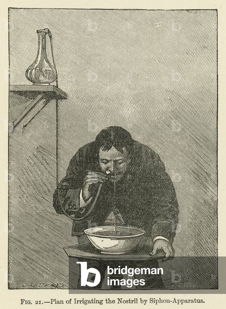 Plan of Irrigating the Nostril by Siphon-Apparatus (litho)