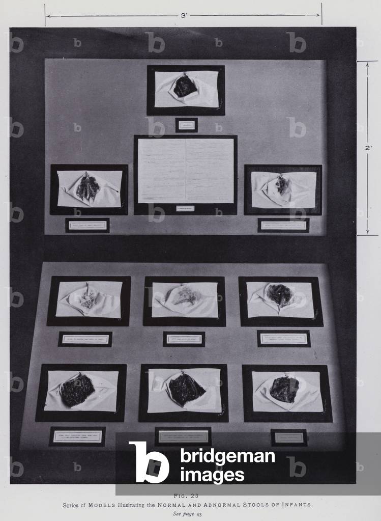 Wellcome Museum: Models, Normal and Abnormal Stools of Infants (b/w photo)