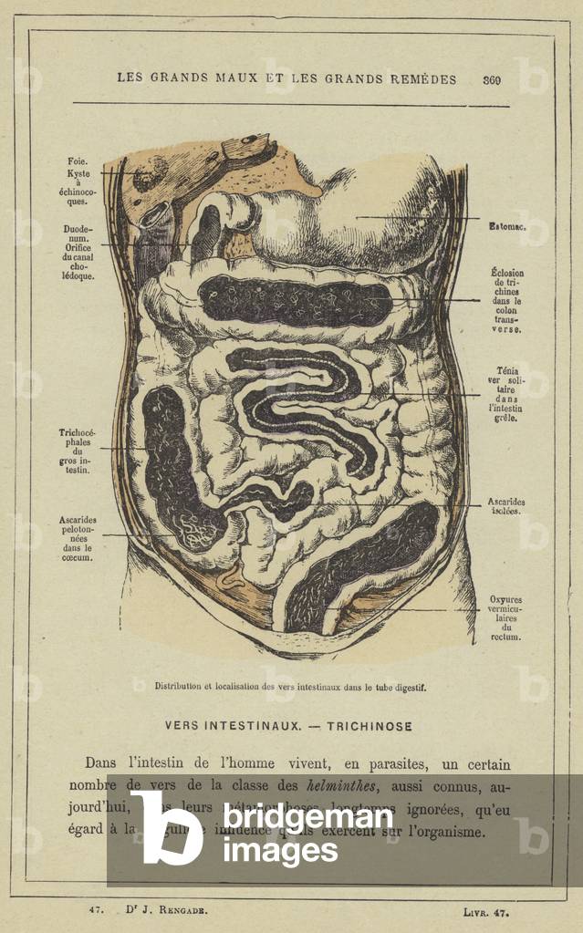 Distribution et localisation des vers intestinaux dans le tube digestif (colour litho)