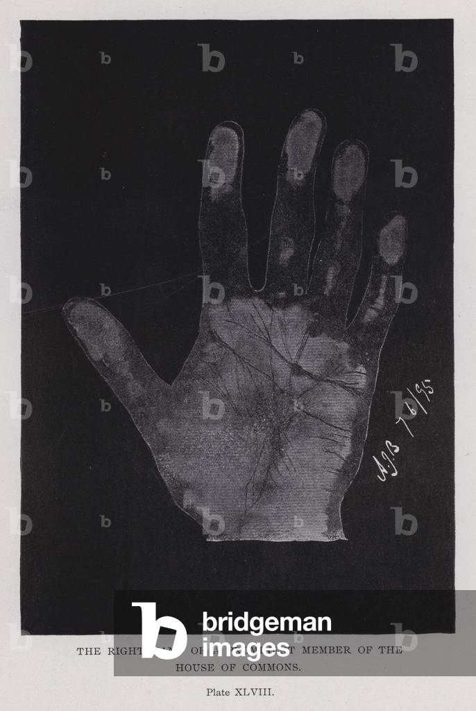 The right hand of a Prominent Member of the House of Commons (b/w photo)