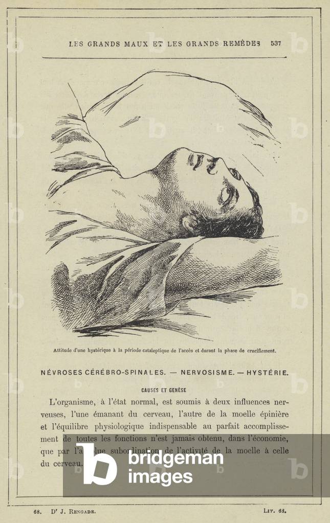 Attitude d'une hysterique a la periode cataleptique de l'acces et durant la phase de crucifiement (colour litho)