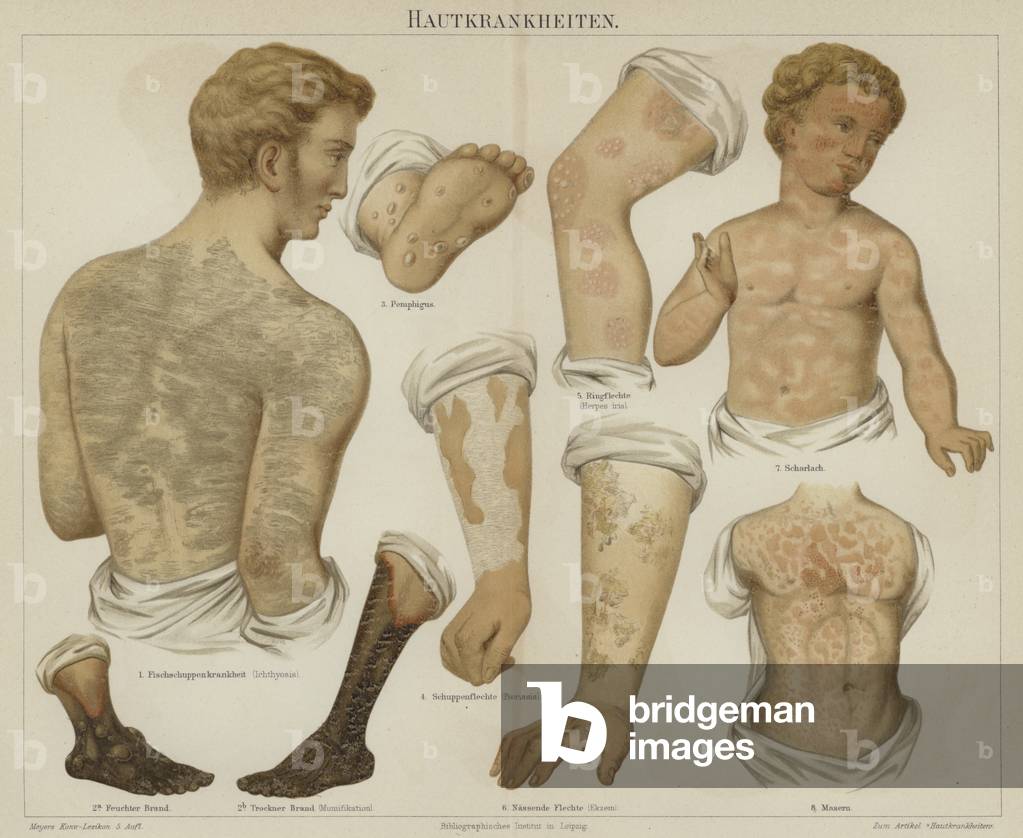 Skin disorders (colour litho)