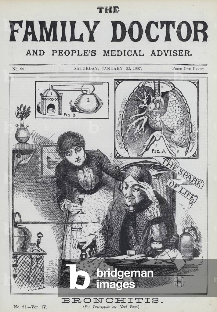 Bronchitis (engraving)