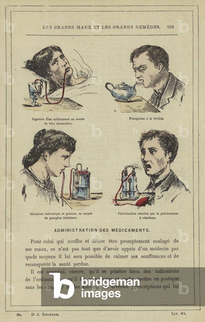 Ingestion d'un medicament au moyen du tube alimentaire, Fumigation a la theiere, Inhalation balsamique et gazeuse, au moyen du gazogene inhalateur, Pulverisation reactive par le pulverisateur a reactions (colour litho)