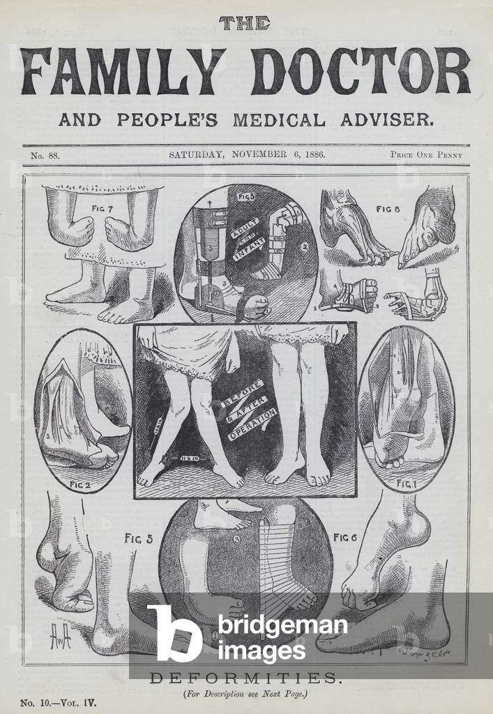 Deformities (engraving)