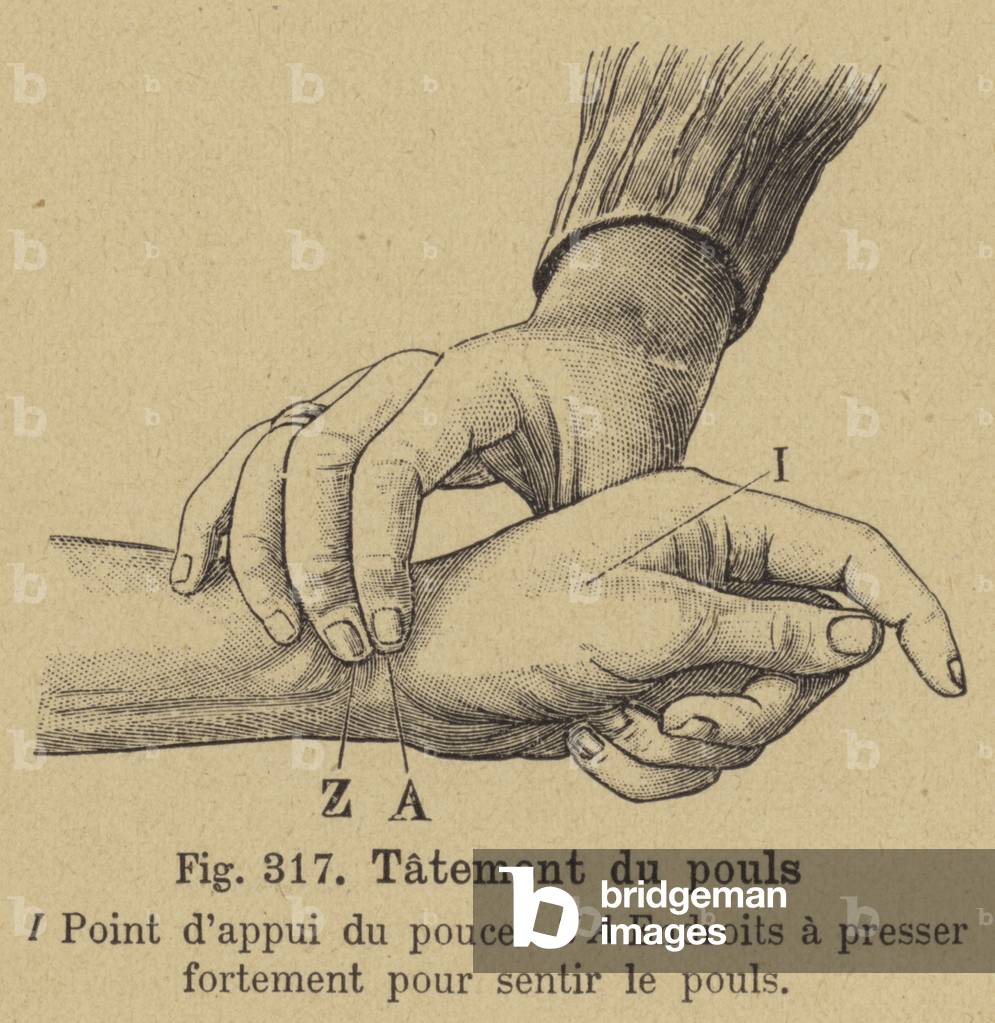 Taking the pulse at the wrist (engraving)