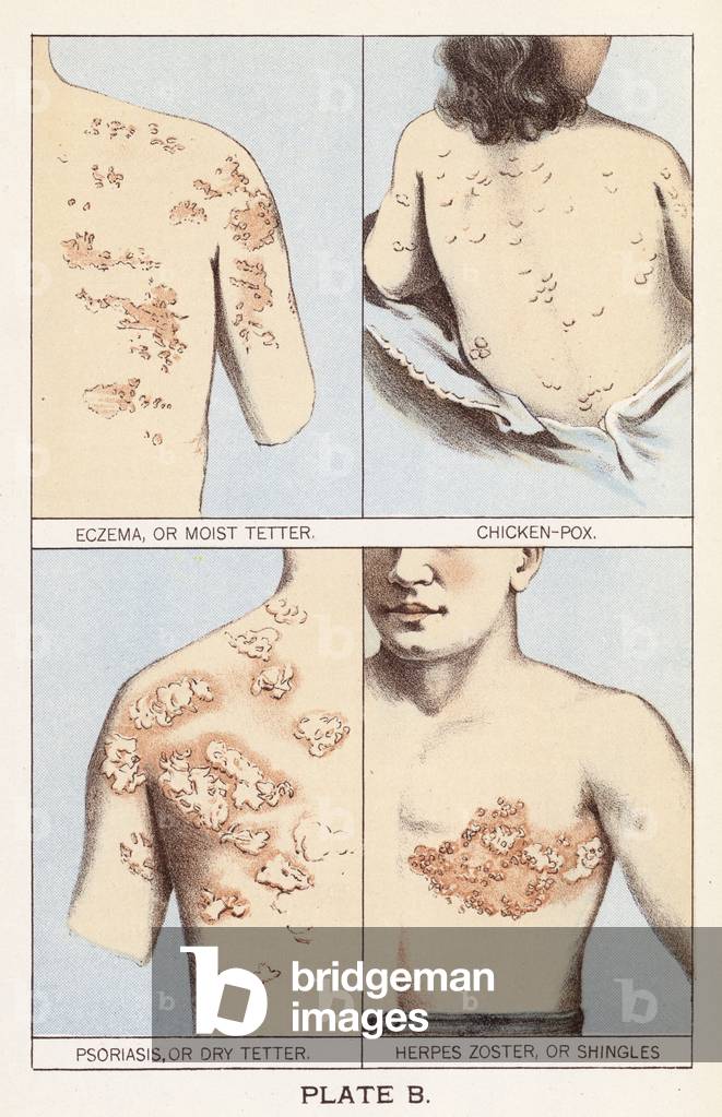 Skin Diseases (colour litho)