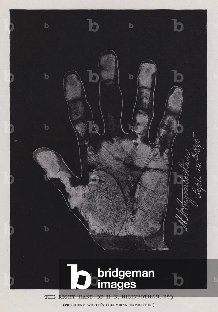 The right hand of H N Higinbotham, President World's Columbian Exposition (b/w photo)