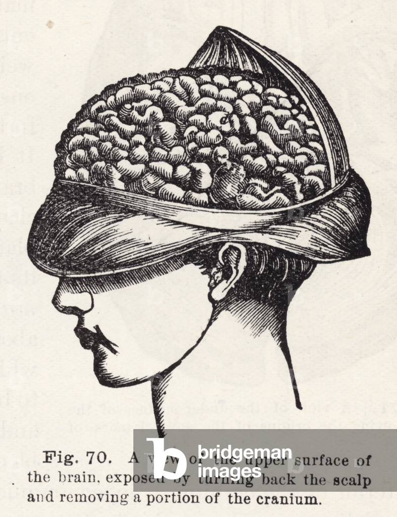 A view of the upper surface of the brain, exposed by turning back the scalp and removing a portion of the cranium (engraving)