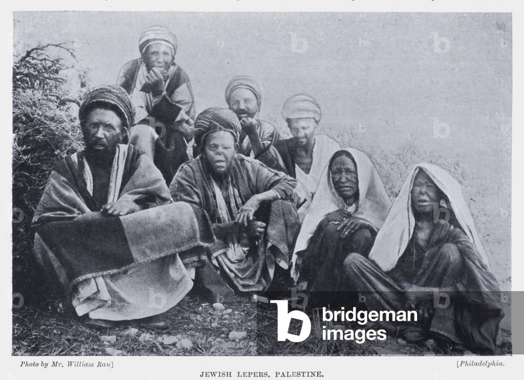 Jewish Lepers, Palestine (b/w photo)