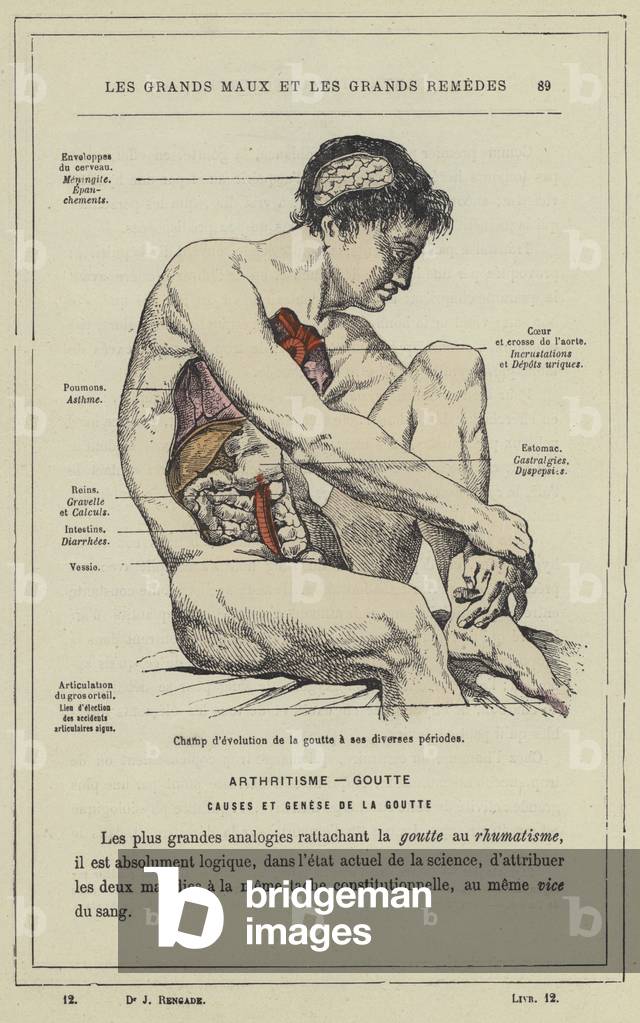 Champ d'evolution de la goutte a ses diverses periodes (colour litho)