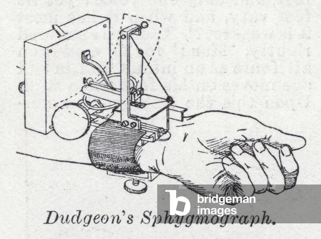 Dudgeon's Sphygmograph (litho)