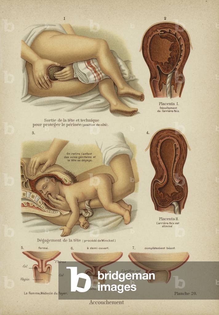 Childbirth (colour litho)
