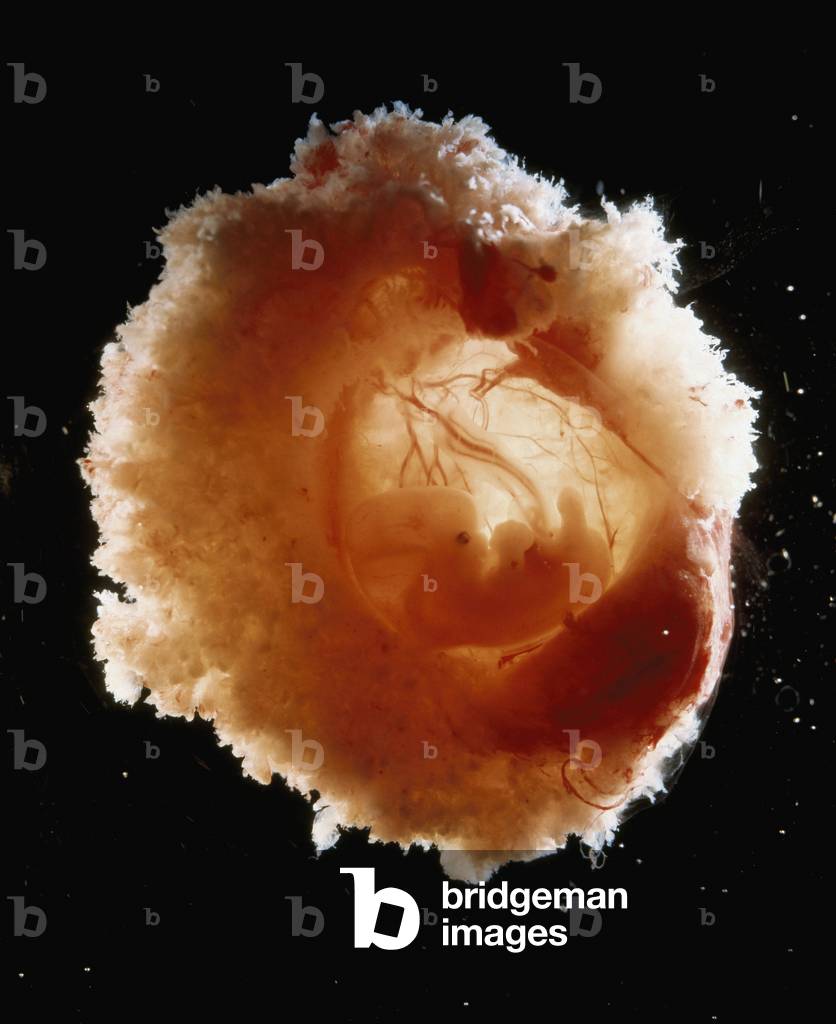 Biology and pregnancy: amniotic pocket containing the human embryo (then fetus) at the fifth week of fecondation (photo)
