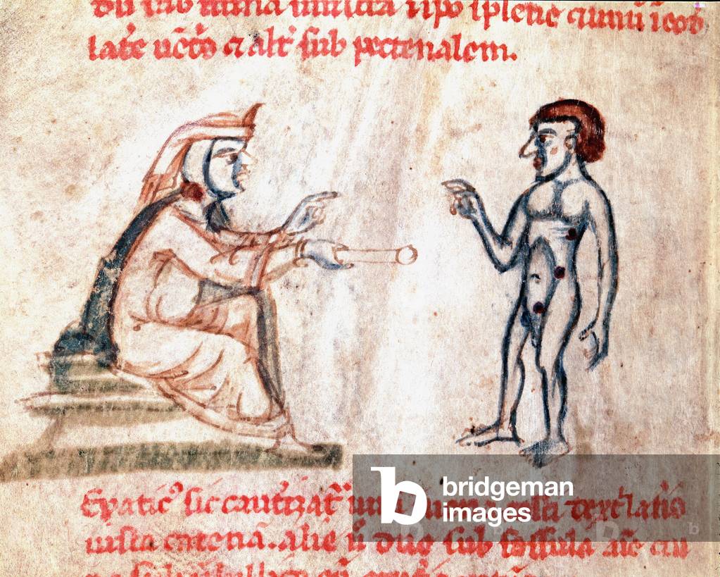 The doctor burns the patient on painful areas with hot irons, 13th century (minniature)