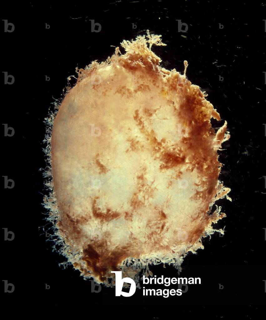 Biology and pregnancy: amniotic pocket containing the human embryo (then fetus) at the second week of fecondation (photo)