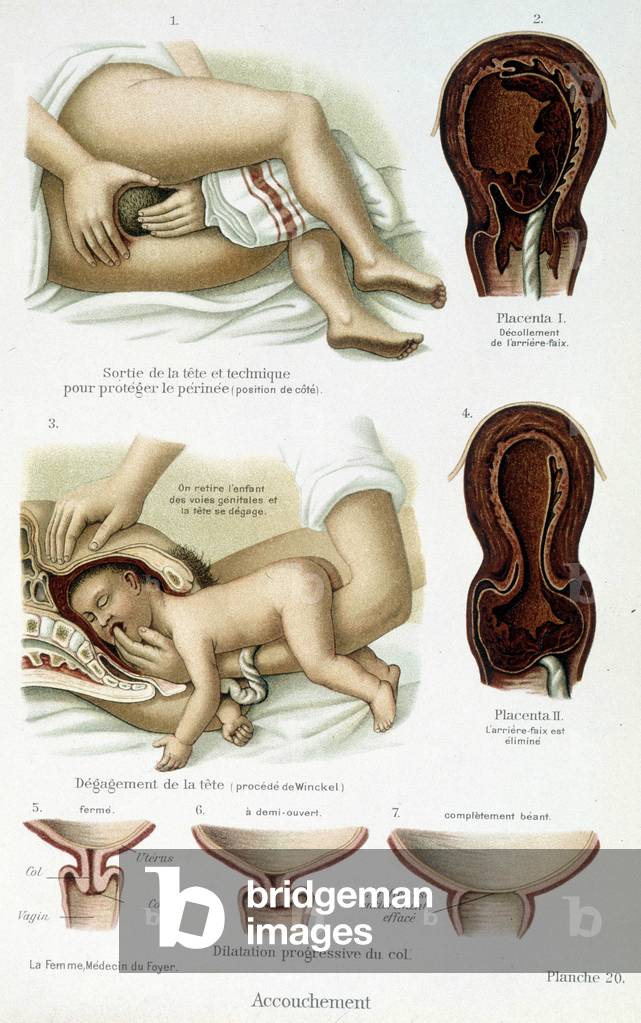 Childbirth - scientific board, late 19th century