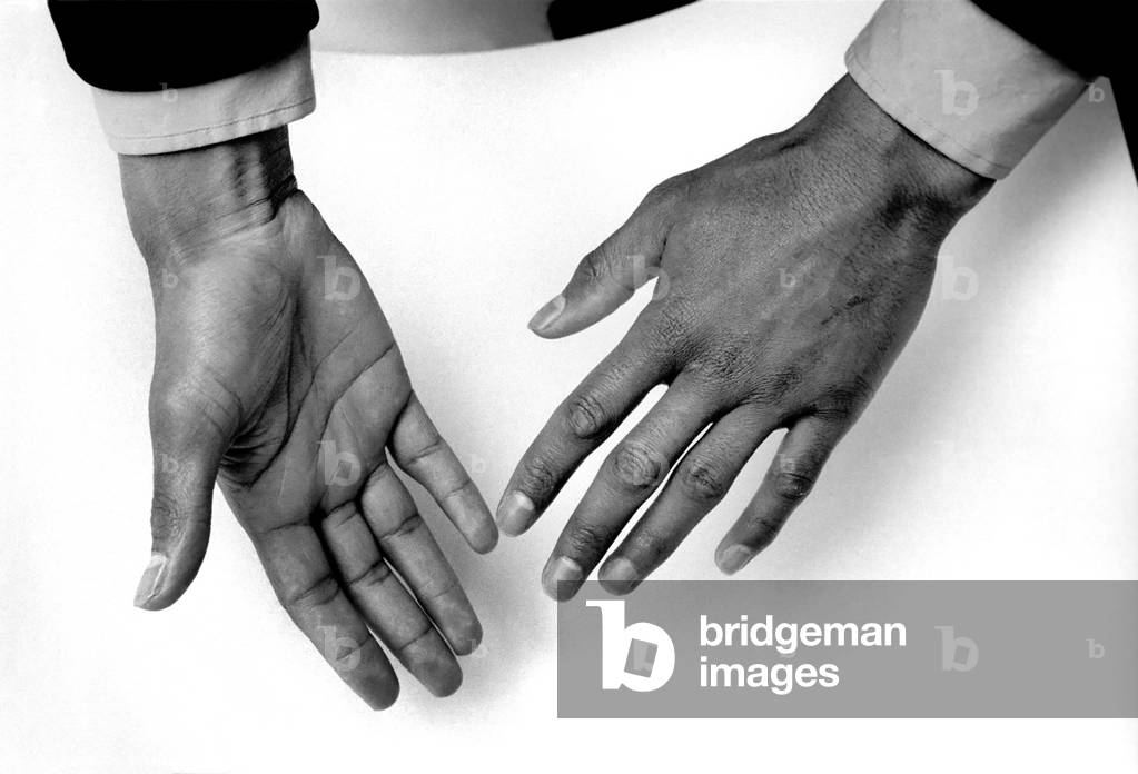 Hands Feature: Hands that have brought cheers to the throats of so many not only on television but in the halls across the world. They are the hands of boxer John Conteh, the champion, January 1975