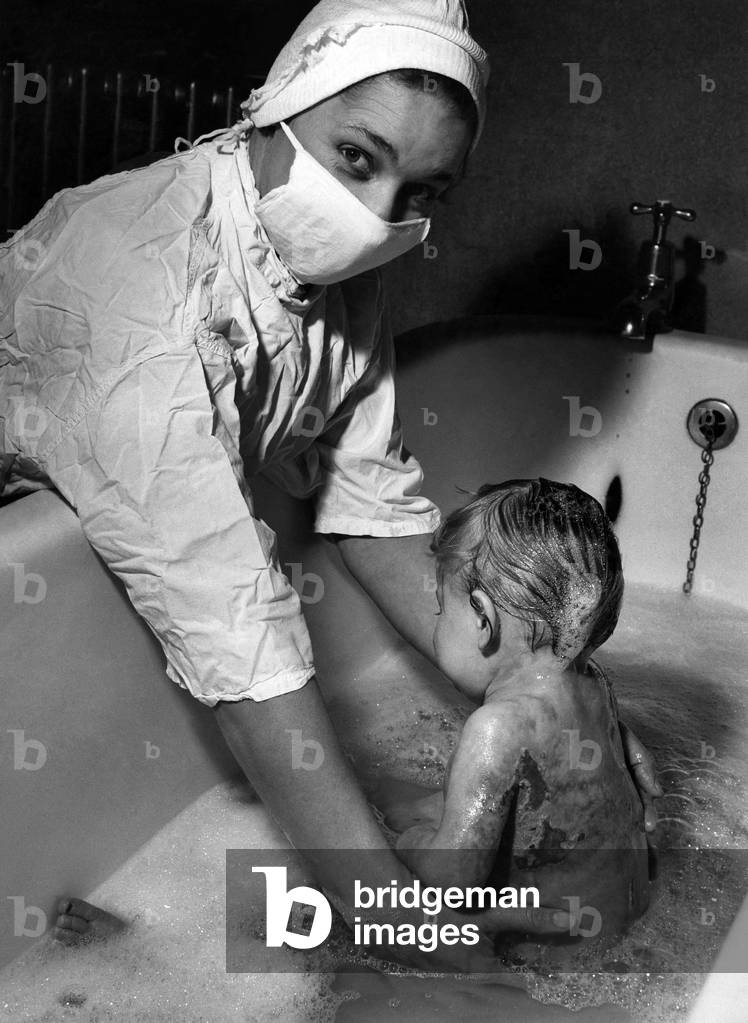 Accidents: Leslie Rowley (15 months) of Glastonbury Crescent, Mossley Estate, Blowich, Staffordshire being bathed by Nurse Hilda Johnston. Leslie has been in hospital for two months with scald burns. December 1960