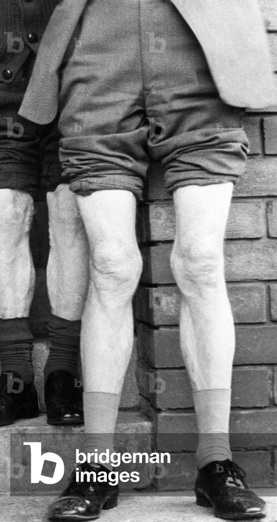 The winner of a knobbly knees competition, 1970 (b/w photo)