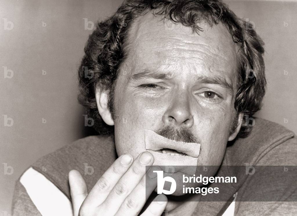 James Whale September 1978
James is a champion kisser of the world. the disc jockey proved the point by planting 4,049 kisses on lovely girls.
Sore lips, 1970s