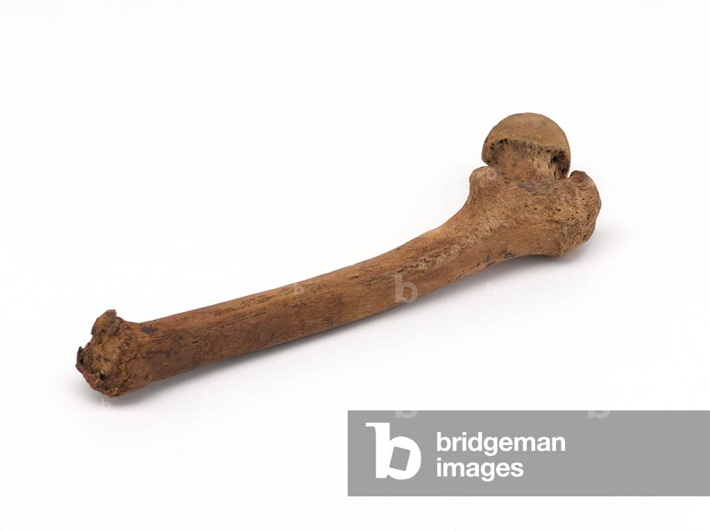 Leg bone of Lieutenant John Fraser, 1782 (human bone)