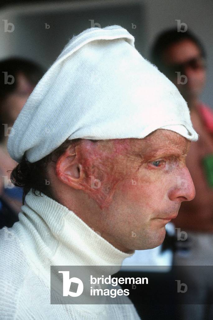Niki Lauda, 1977 (photo)
