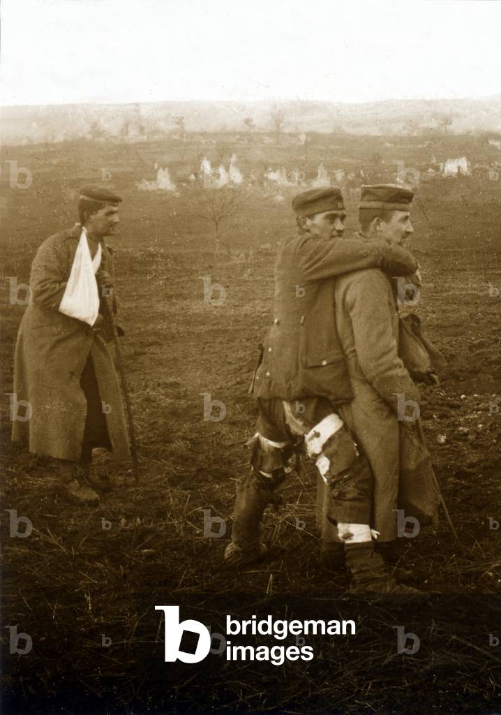 First World War - stereoscopic glass plate LSU 1914-1918 (14-18) - French war wounded soldiers - Publishers during World War I routinely published in newspapers calls for hairy people to transmit their photos, which were then widely disseminated -