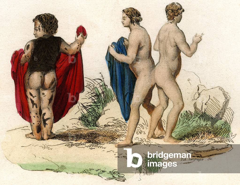 Human curiosites: girl whose body is strewn with spots covered with thicker hair  and twins women (Siamese), 19th century (Engraving)