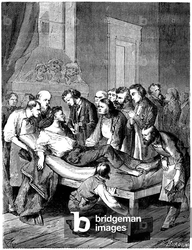 First surgical operation with sulfuric ether anesthesia at Boston Hospital by William Morton, 19th century (engraving)