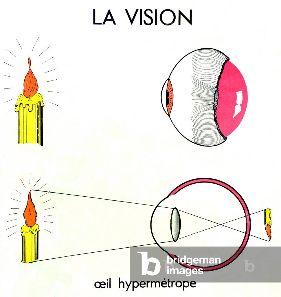 Vision: normal eye and hypermetrope - example with projection and inverted reproduction of a candle image lit through the lens: with a normal eye the image forms on the retn, with a hypermetrope eye it forms back of the retn (near blurred object) - hypermetropy - view - accomodation - focus - look - detail of a Pedagogic panel (natural science) Nightingale, place on the walls of the school in the years 1950-1960