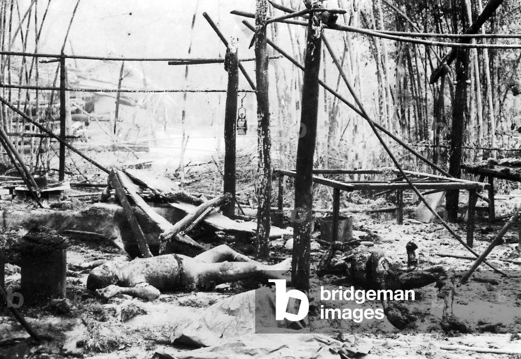 Vietnam: Victims of US napalm bombing, Cu Chi, South Vietnam, Second Indochina War (Vietnam War) (1966)