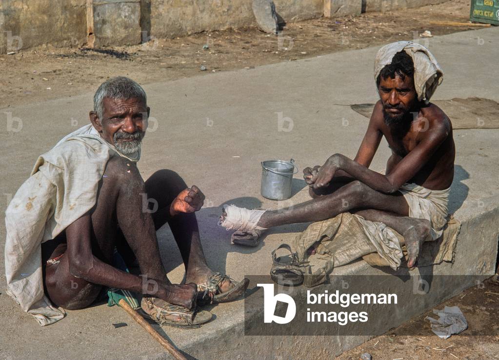 Leprosy patient at CMC Hospital, Vellore, Tamil Nadu, South India (photo)
