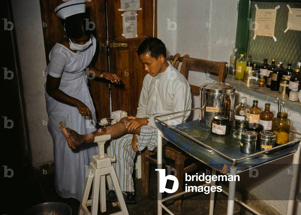 Patient with infected leg attending clinic at CMC Hospital, Vellore, Tamil Nadu, South India (photo)