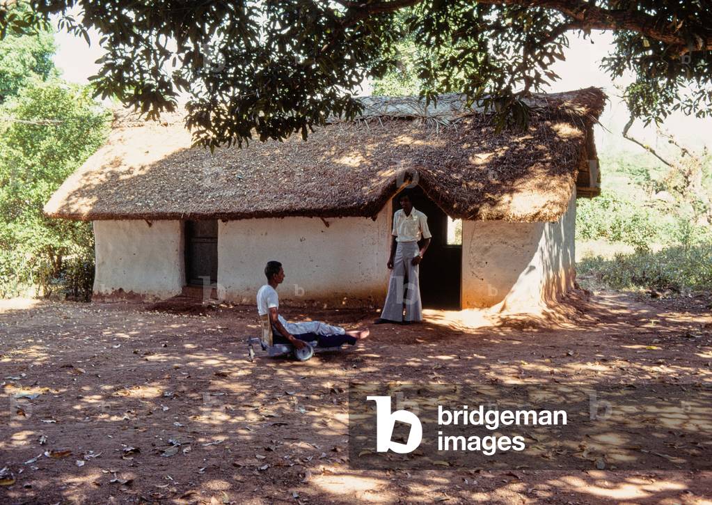 Leprosy patient at CMC Hospital, Vellore, Tamil Nadu, India, 1980 (photo)