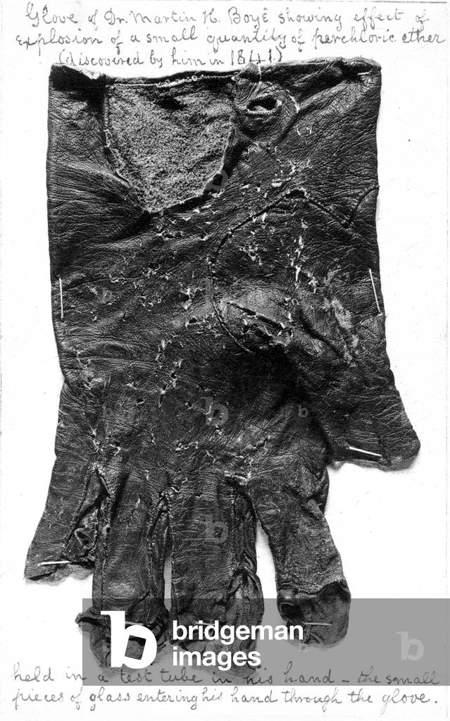 Effects of explosion of perchloric etheron a glove (b/w photo)