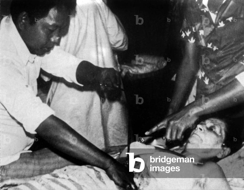 Philippine healer Tony Agpaoa during an operation with his hands (he's opening a body with his hands) in 1977 in Philippines