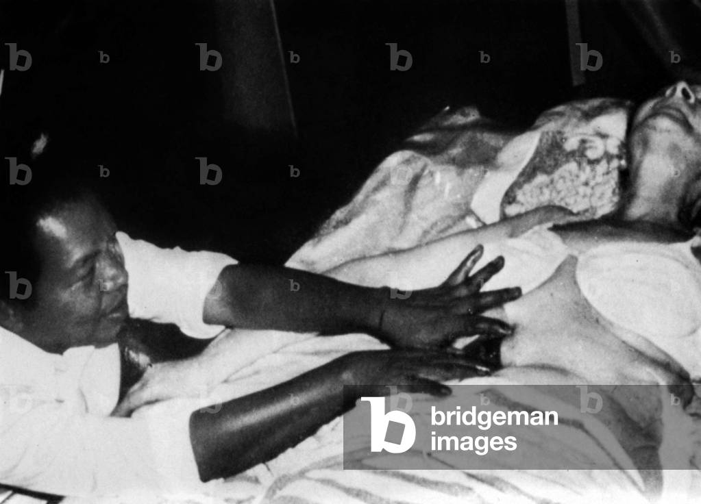 Philippine healer Tony Agpaoa during an operation with his hands (he's opening a body with his hands) in 1977 in Philippines