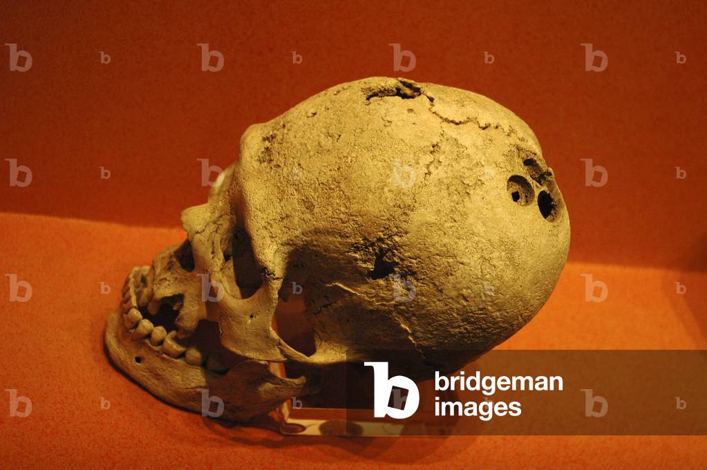 Mexico, Oaxaca, Monte Alban (orig. 200 Bcentury) Museum, skull to show trepanning (early brain surgery)