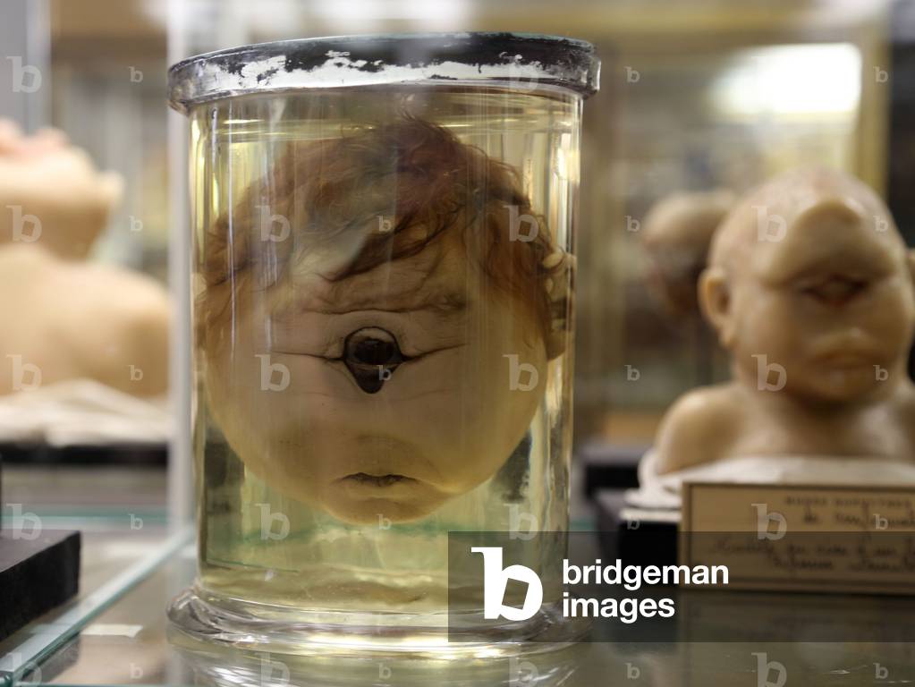 Pathological anatomy, 1850-1905 (photo)