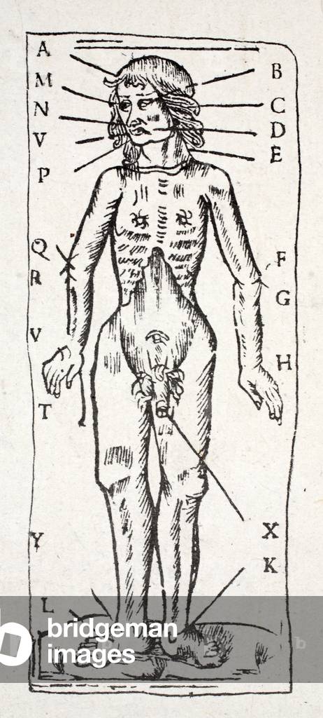 A body which has been under the scalpel, with veins labelled (litho)