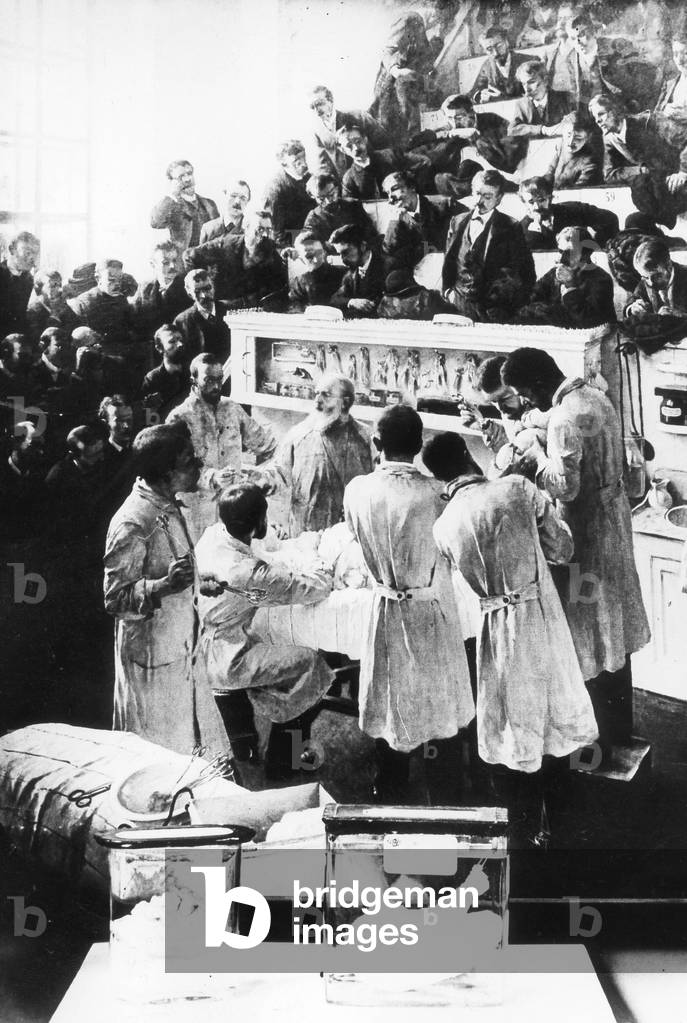 Gastric surgery, 1881