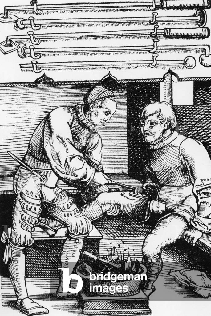 Cauterizing of a wound, 1528